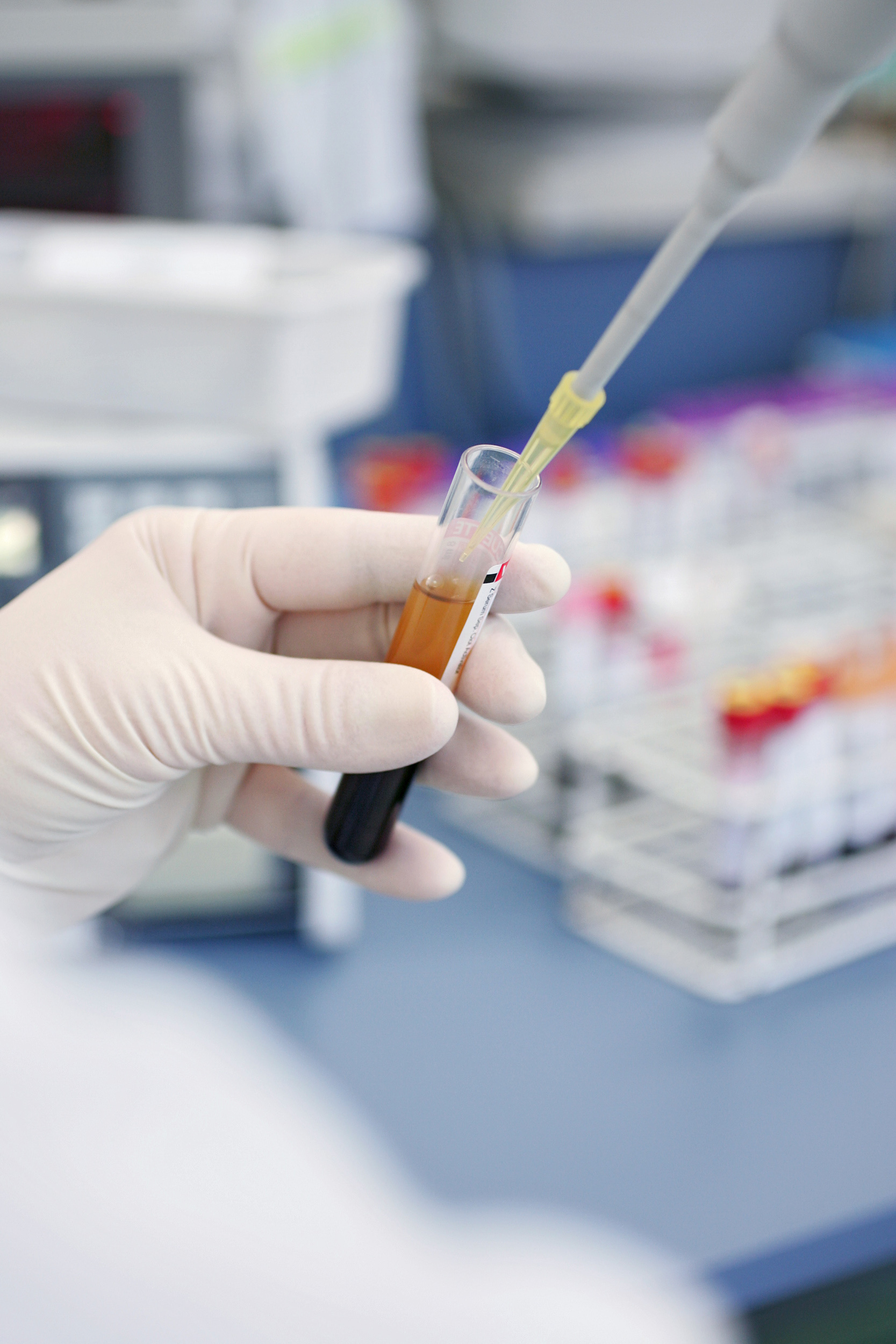 Reagenzglas mit einer Blutprobe wird im Labor mit einer weiteren Flüssigkeit aufgefüllt