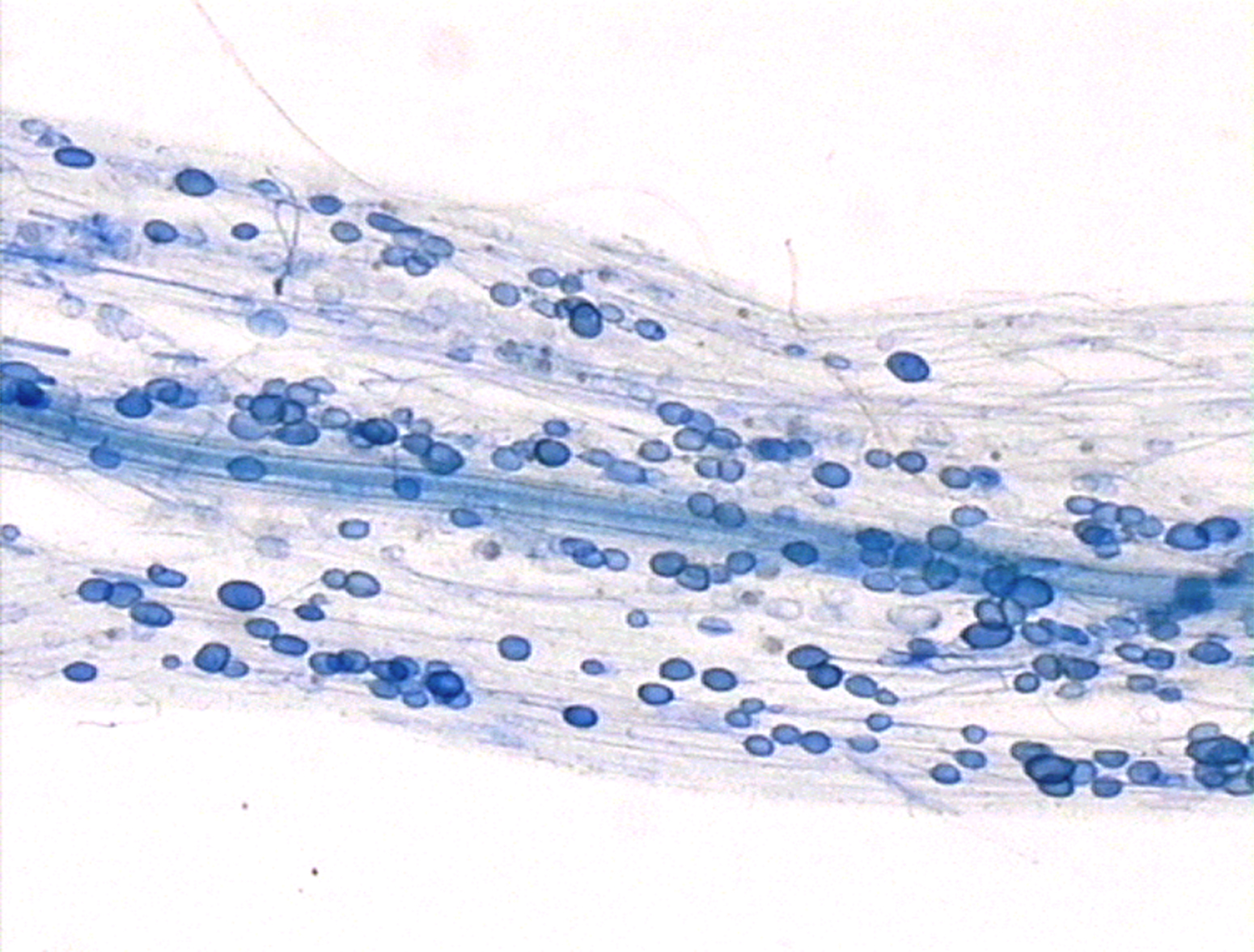 Hier sieht man die Symbiose zwischen Pilzen und Pflanzen: Mykorrhiza. In einer Wurzel sind mal blau angefärbte Punkte