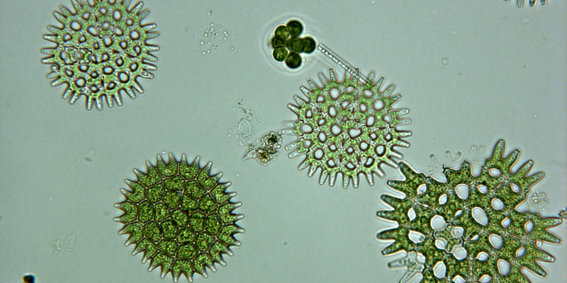 Mikroskopaufnahme der Grünalge
