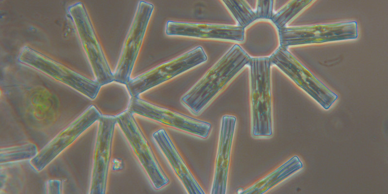 Eine Mikroskopaufnahme der Kieselalge Tabellaria flocculosa