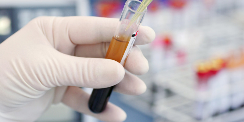 Reagenzglas mit einer Blutprobe wird im Labor mit einer weiteren Flüssigkeit aufgefüllt