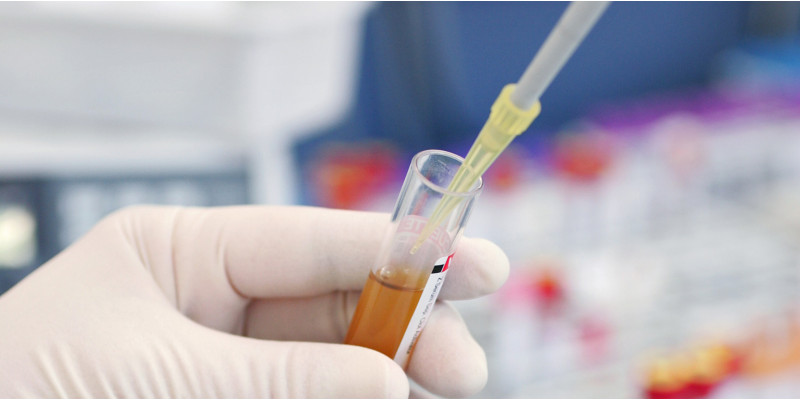 Person in Laborkleidung hält ein Reagenzglas mit Blut und verwendet eine Mikroliterpipette zur Probenentnahme
