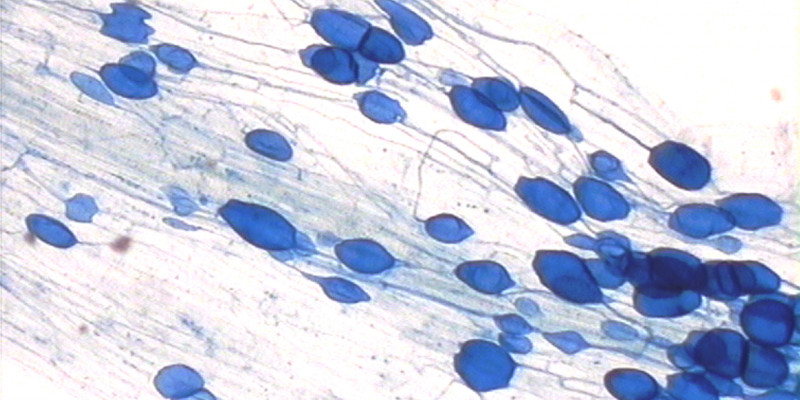 Lichtmikroskopbild einer Feinwurzel, die eine Symbiose mit einem Pilz eingegangen ist. Der Pilz ist als blaue Knubbel in der Fadenförmigen Struktur zu sehen