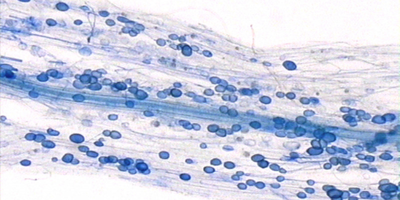 You can see the symbiosis of funguses and plants: mycorrhiza. There are blue-coloured dots in one root.