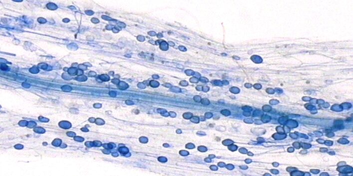 Hier sieht man die Symbiose zwischen Pilzen und Pflanzen: Mykorrhiza. In einer Wurzel sind mal blau angefärbte Punkte