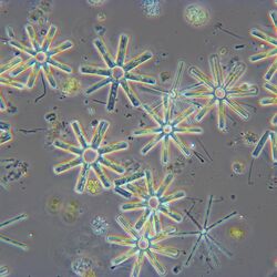 Eine Mikroskopaufnahme der Kieselalge Tabellaria flocculosa