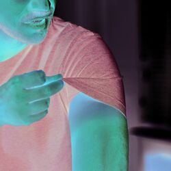 Das Bild zeigt im Fokus den Oberarm eines Mannes. Mit zwei Fingern hebt der Mann den Ärmel seines T-Shirts an. Im Unterschied zur vom Shirt zuvor bedeckten Haut ist die der Sonne ausgesetzte Haut durch Sonnenbrand stark gerötet.