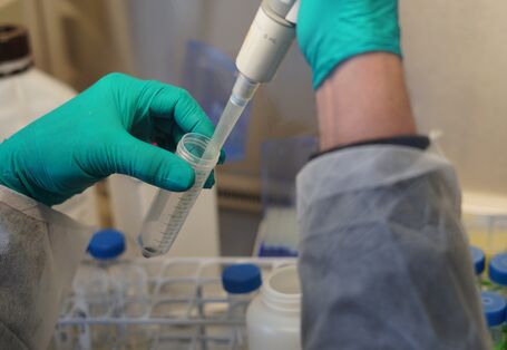 Konzentrierung Proben