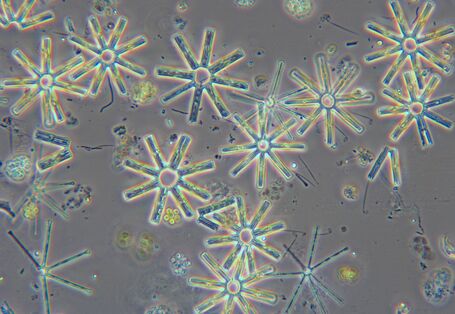 Eine Mikroskopaufnahme der Kieselalge Tabellaria flocculosa