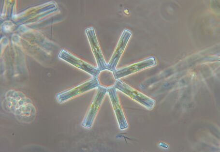 Eine Mikroskopaufnahme der Kieselalge Tabellaria flocculosa