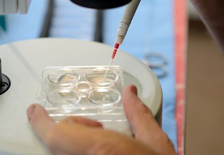 Foto einer Transferpipette, mit der Kalb-Embryonen in einem Zuchtlabor aufgenommen werden.