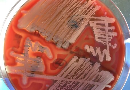 Foto: Methicillin resistente Staphylococcus aureus aus Schweineabstrichen isoliert auf einer Blut-Agar-Platte