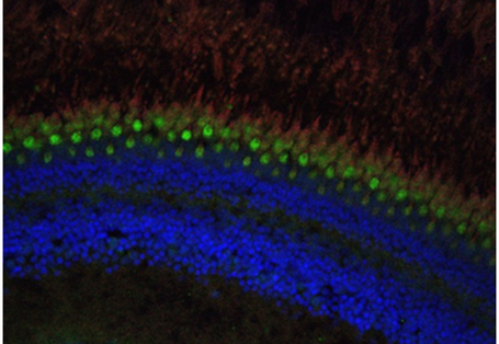 Die runden Linien der Retina heben sich regenbogen-farben vom schwarzen Hintergrund ab