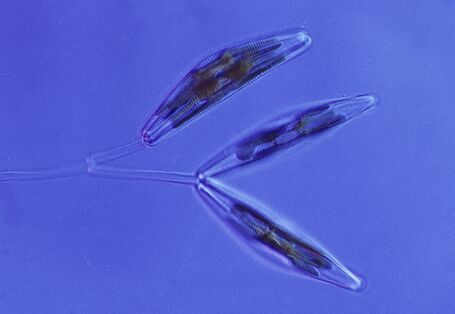 Mikroskopaufnahme einer Kieselalge mit den zwei Kalkschalen