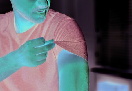 Das Bild zeigt im Fokus den Oberarm eines Mannes. Mit zwei Fingern hebt der Mann den Ärmel seines T-Shirts an. Im Unterschied zur vom Shirt zuvor bedeckten Haut ist die der Sonne ausgesetzte Haut durch Sonnenbrand stark gerötet.