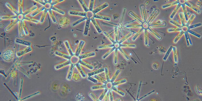 Eine Mikroskopaufnahme der Kieselalge Tabellaria flocculosa