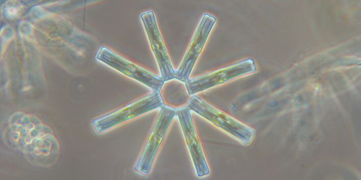 Eine Mikroskopaufnahme der Kieselalge Tabellaria flocculosa