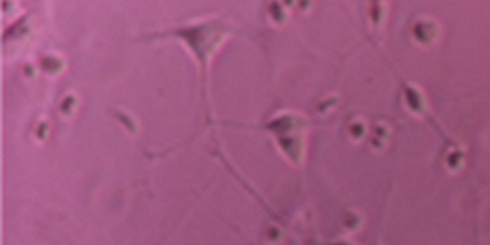 Mikroskopische Aufnahme: mit Differenzierungsfaktor behandelte Zellen