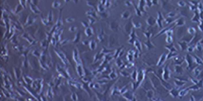 Mikroskopische Aufnahme: unbehandelte Nervenzellen